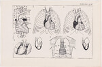 Czesław Słania "Atlas anatomiczny" tablica 2, LI rysunek "Topografia serca"